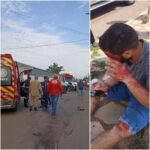 Acidente envolvendo motocicleta e viatura da PM deixa mulher ferida em Porangatu