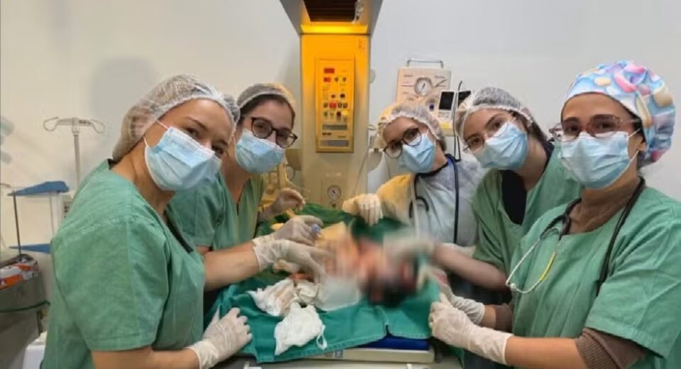 Bebês siameses unidos pelo abdômen nascem em Goiânia — Foto: Reprodução/TV Anhanguera