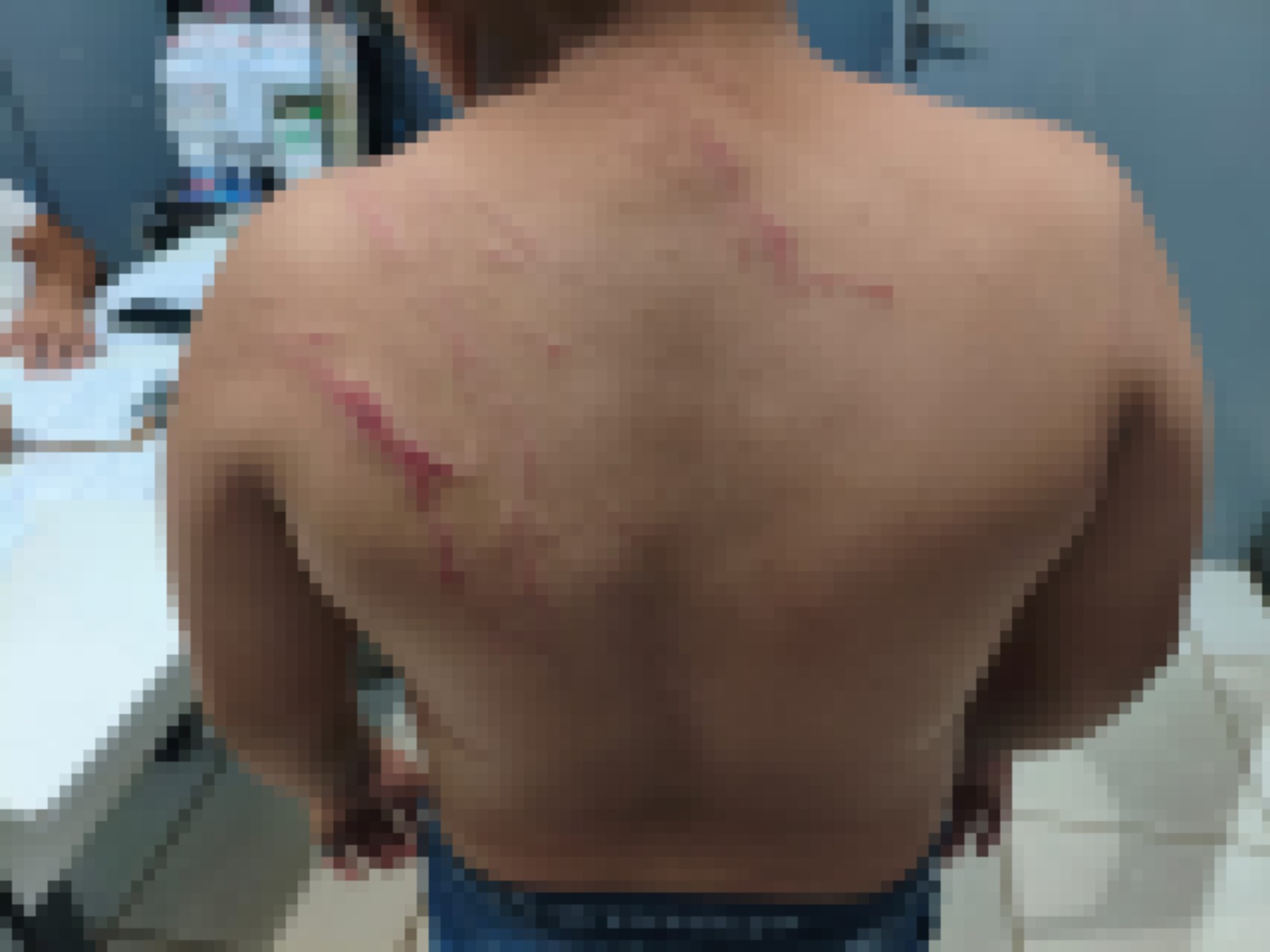 Foto: Adolescente apresentava lesões no rosto, braços e costas