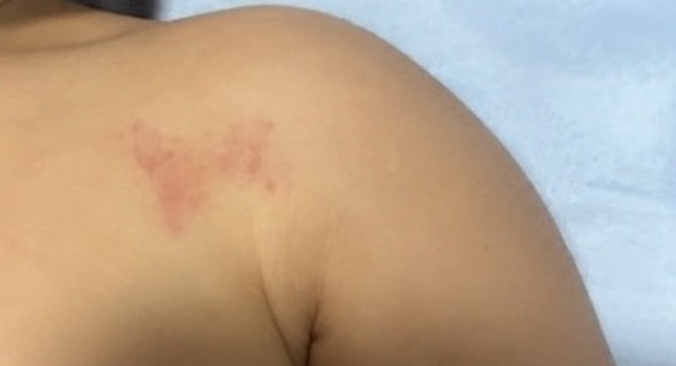 Criança voltou para casa com hematomas pelo corpo, e caso está sendo investigado pela Polícia Civil, segundo a família