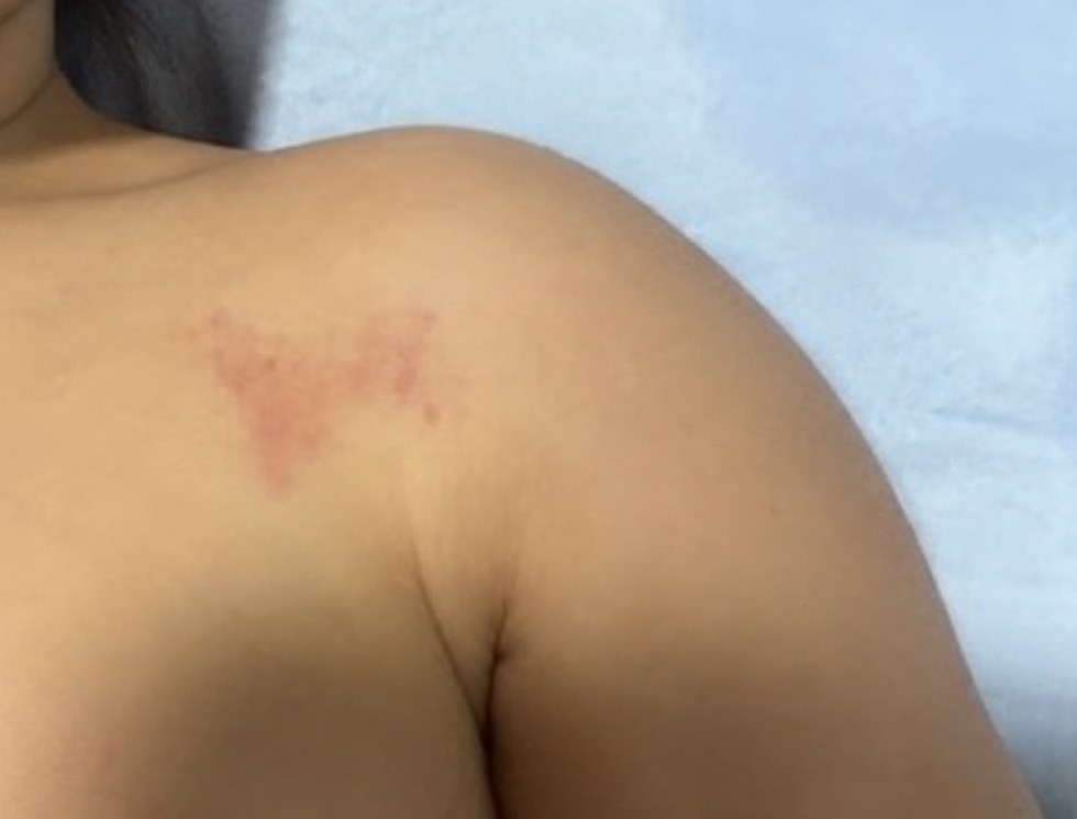 Criança voltou para casa com hematomas pelo corpo, e caso está sendo investigado pela Polícia Civil, segundo a família