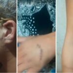 Pai e filha morrem após moto ser atingida por caminhonete e caminhão em Goiânia