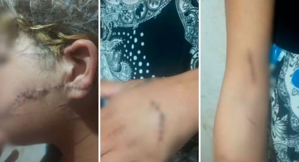 Mulher sofreu cortes em diferentes regiões do corpo, em Goiás — Foto: Reprodução/TV Anhanguera