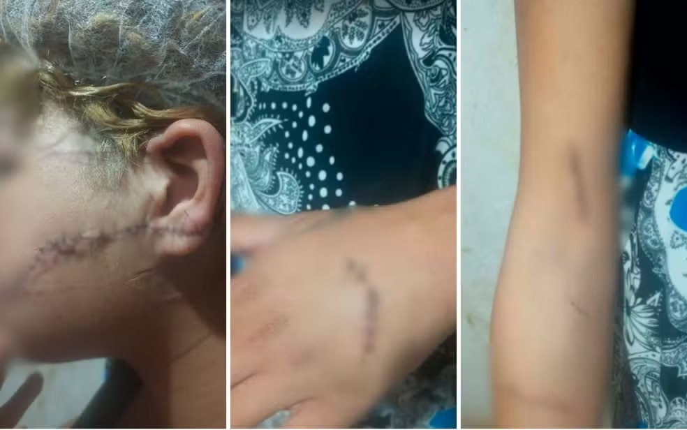 Homem suspeito de atacar duas ex-companheiras é preso em Niquelândia