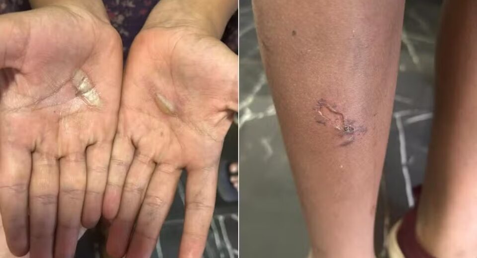Pai é preso suspeito de torturar filhas após caixa de som ser quebrada acidentalmente