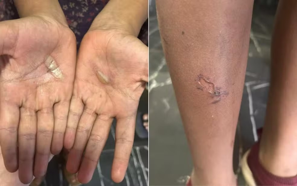 Pai é preso suspeito de torturar filhas após caixa de som ser quebrada acidentalmente